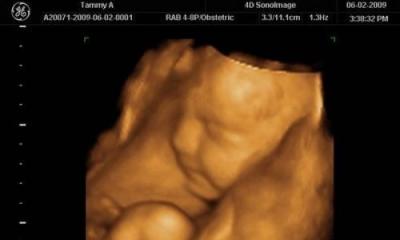 31 tednov nosečnosti: kaj se zgodi z otrokom in materjo, fotografije, razvoj ploda