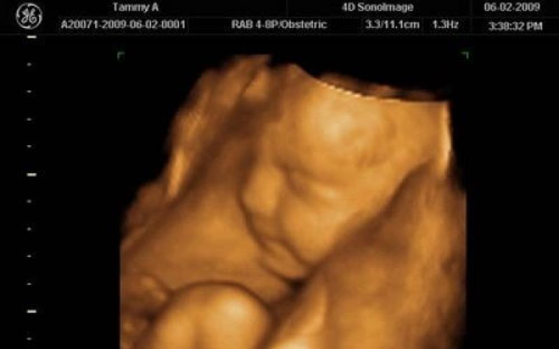 31 semanas de embarazo: qué le sucede al bebé y a la madre, foto, desarrollo fetal